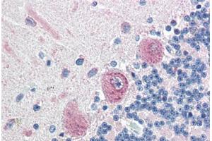 Human Brain, Cerebellum (formalin-fixed, paraffin-embedded) stained with KIAA0152 antibody ABIN351427 at 5 ug/ml followed by biotinylated goat anti-rabbit IgG secondary antibody ABIN481713, alkaline phosphatase-streptavidin and chromogen. (Malectin antibody  (N-Term))