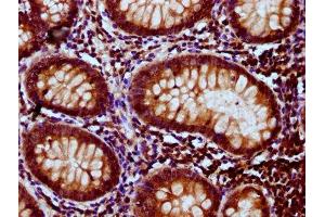 IHC image of ABIN7166205 diluted at 1:300 and staining in paraffin-embedded human appendix tissue performed on a Leica BondTM system. (Sec23 Homolog B antibody  (AA 208-325))