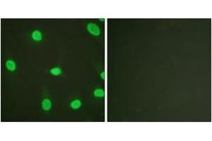 Immunofluorescence analysis of HeLa cells, using Ku80 (Ab-714) Antibody. (XRCC5 antibody  (AA 683-732))