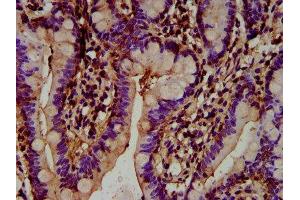 IHC image of ABIN7164423 diluted at 1:300 and staining in paraffin-embedded human small intestine tissue performed on a Leica BondTM system. (HECTD2 antibody  (AA 674-776))