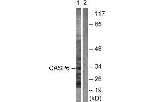 Immunohistochemical analysis of paraffin-embedded human breast carcinoma tissue using Caspase 6 (Ab-257) antibody. (Caspase 6 antibody)