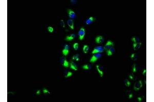 Immunofluorescence staining of Hela cells with ABIN7156385 at 1:133, counter-stained with DAPI. (ITM2B antibody  (AA 81-148))