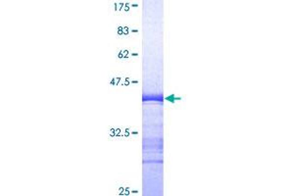 ERK1 Protein (AA 279-379) (GST tag)