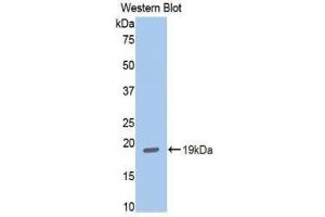 Western Blotting (WB) image for anti-Hexokinase 1 (HK1) (AA 530-675) antibody (ABIN1859171)