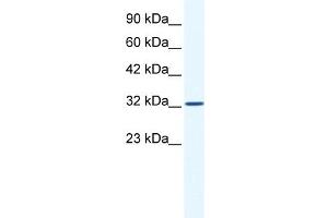 WB Suggested Anti-SNAPC2 Antibody Titration:  1. (SNAPC2 antibody  (Middle Region))