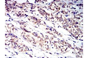 Immunohistochemistry (IHC) image for anti-Colony Stimulating Factor 3 Receptor (Granulocyte) (CSF3R) (AA 25-187) antibody (ABIN5611136)