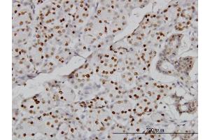 Immunoperoxidase of monoclonal antibody to CMAS on formalin-fixed paraffin-embedded human salivary gland. (CMAS antibody  (AA 164-263))