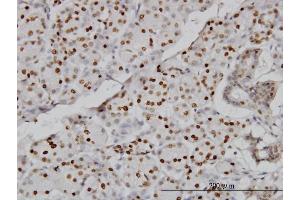 Immunoperoxidase of monoclonal antibody to CMAS on formalin-fixed paraffin-embedded human salivary gland.