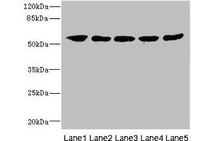 Western blot, All lanes: IFNLR1 antibody at 3.