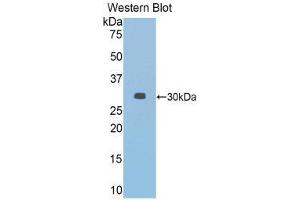 Western Blotting (WB) image for anti-Janus Kinase 2 (JAK2) (AA 564-809) antibody (ABIN1859523)