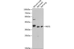 Western blot analysis of extracts of various cell lines, using MLF1 antibody (ABIN6128237, ABIN6143874, ABIN6143876 and ABIN6217281) at 1:1000 dilution. (MLF1 antibody  (AA 1-268))