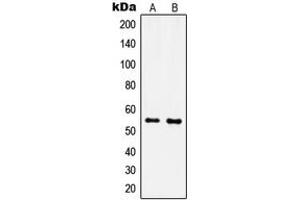 Western blot analysis of IPPK expression in MCF7 (A), NIH3T3 (B) whole cell lysates. (IPPK antibody  (N-Term))