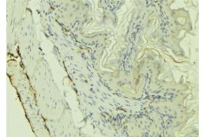 ABIN6273220 at 1/100 staining Mouse colon tissue by IHC-P.