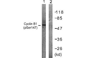 Immunohistochemistry analysis of paraffin-embedded human placenta tissue using Cyclin B1 (Phospho-Ser147) antibody. (Cyclin B1 antibody  (pSer147))