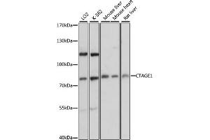 Western blot analysis of extracts of various cell lines, using CT antibody (ABIN6129529, ABIN6139174, ABIN6139175 and ABIN6217150) at 1:3000 dilution. (CTAGE1 antibody  (AA 370-520))