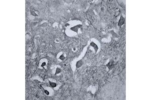 IHC on mouse brain (cryo section) using Rabbit antibody to RhoA  at a concentration of 15 µg/ml, incubated overnight and developed with DAB Ni. (RHOA antibody  (AA 100-150))