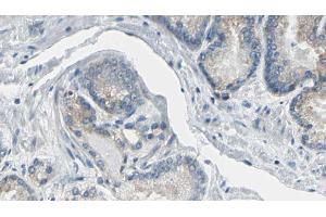ABIN6269374 at 1/100 staining Human prostate tissue by IHC-P. (CDC37 antibody  (N-Term))