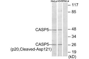 Western blot analysis of extracts from HeLa cells and A549 cells, treated with etoposide (25uM, 24hours), using CASP5 (p20, Cleaved-Asp121) antibody. (CASP5 antibody  (Cleaved-Asp121, Internal Region))
