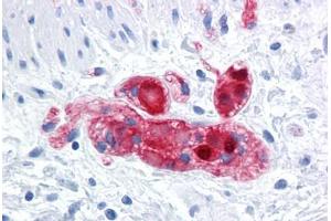 Human Colon, submucosal plexus: Formalin-Fixed, Paraffin-Embedded (FFPE) (SCGN antibody  (AA 1-277))