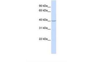 Image no. 1 for anti-Acyl-CoA Dehydrogenase, C-2 To C-3 Short Chain (Acads) (AA 110-159) antibody (ABIN6738922) (ACADS antibody  (AA 110-159))