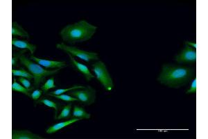 Immunofluorescence of purified MaxPab antibody to PCID2 on HeLa cell. (PCID2 antibody  (AA 1-397))