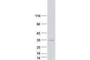 Validation with Western Blot (BHLHE23 Protein (Myc-DYKDDDDK Tag))