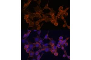 Immunofluorescence analysis of NIH/3T3 cells using β-arrestin1 antibody (ABIN6127452, ABIN6137135, ABIN6137136 and ABIN6213655) at dilution of 1:100. (beta Arrestin 1 antibody  (AA 169-418))