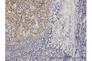 Immunoperoxidase of purified MaxPab antibody to VPREB3 on formalin-fixed paraffin-embedded human tonsil. (VPREB3 antibody  (AA 1-123))