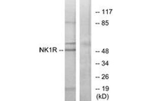 Western blot analysis of extracts from Jurkat cells, using NK1R Antibody.