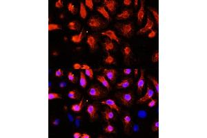 Immunofluorescence analysis of HeLa cells using  antibody (ABIN1678557, ABIN3017993, ABIN3017994, ABIN5664400 and ABIN6220331) at dilution of 1:100 (40x lens). (ACTN2 antibody  (AA 1-250))