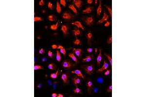 Immunofluorescence analysis of HeLa cells using  antibody (ABIN1678557, ABIN3017993, ABIN3017994, ABIN5664400 and ABIN6220331) at dilution of 1:100 (40x lens). (ACTN2 antibody  (AA 1-250))