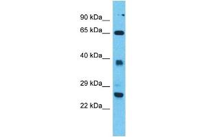 Western Blotting (WB) image for anti-Tetratricopeptide Repeat Domain 26 (TTC26) (N-Term) antibody (ABIN2500795) (TTC26 antibody  (N-Term))