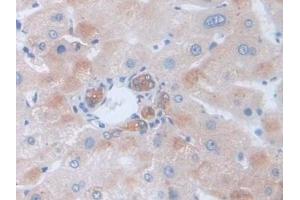 Detection of GLa in Human Liver Tissue using Polyclonal Antibody to Galactosidase Alpha (GLa) (GLA antibody  (AA 81-429))