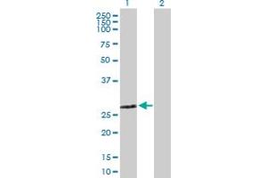ZMYND19 antibody  (AA 1-227)