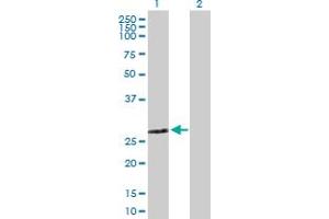 ZMYND19 antibody  (AA 1-227)