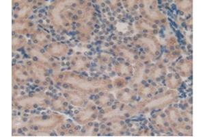 IHC-P analysis of Rat Kidney Tissue, with DAB staining. (SFTPB antibody  (AA 111-329))