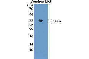Detection of Recombinant IL22R, Rat using Polyclonal Antibody to Interleukin 22 Receptor (IL22R) (IL22R antibody  (AA 242-485))