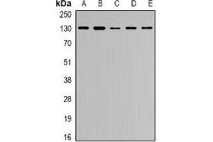 Western blot analysis of Collagen 4 alpha 1 expression in Hela (A), MCF7 (B), U2OS (C), HEK293T (D), VEC (E) whole cell lysates.