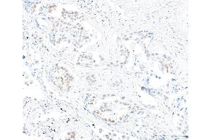 Immunohistochemistry (IHC) image for anti-Mismatch Repair Protein 2 (MSH2) (AA 625-675) antibody (ABIN7453978) (Recombinant MSH2 antibody  (AA 625-675))