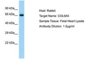Image no. 1 for anti-Collagen, Type VI, alpha 5 (COL6A5) (AA 2427-2476) antibody (ABIN6750094) (Collagen, Type VI, alpha 5 (COL6A5) (AA 2427-2476) antibody)