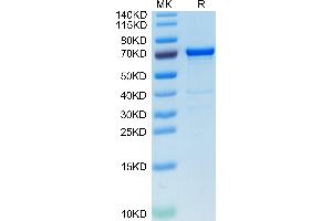 alpha Fetoprotein Protein (AA 19-609) (His tag)