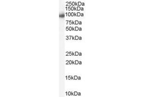 Western Blotting (WB) image for anti-Aurora Kinase A (AURKA) (Middle Region) antibody (ABIN2785452)