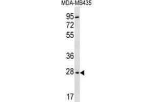 Western Blotting (WB) image for anti-2,3-bisphosphoglycerate Mutase (BPGM) antibody (ABIN2996852)