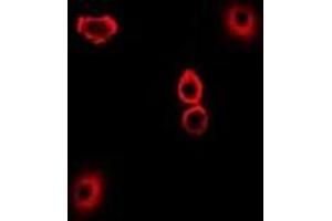 Immunofluorescent analysis of TXNL1 staining in U2OS cells. (TXNL1 antibody)