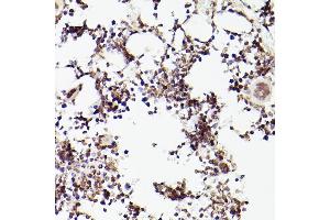 Immunohistochemistry of paraffin-embedded rat bone marrow using TET2 antibody (ABIN1513598, ABIN3022074, ABIN3022075 and ABIN6218597) at dilution of 1:100 (40x lens).