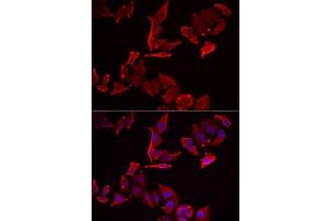 Immunofluorescence analysis of MCF7 cells using SK antibody . (SKAP2 antibody  (AA 1-120))
