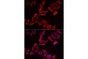 Immunofluorescence analysis of MCF7 cells using SK antibody . (SKAP2 antibody  (AA 1-120))
