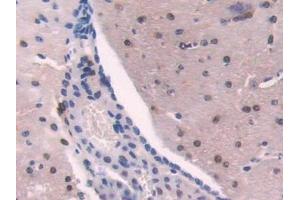 Detection of ADK in Mouse Cerebrum Tissue using Polyclonal Antibody to Adenosine Kinase (ADK) (ADK antibody  (AA 1-361))