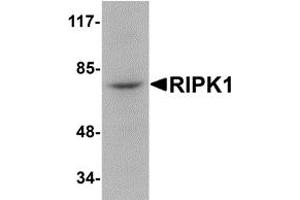 Western Blotting (WB) image for anti-Receptor (TNFRSF)-Interacting serine-threonine Kinase 1 (RIPK1) (N-Term) antibody (ABIN1031543) (RIPK1 antibody  (N-Term))