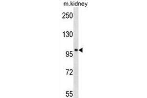 Western Blotting (WB) image for anti-tyrosine Kinase, Non-Receptor, 2 (TNK2) antibody (ABIN3003439) (TNK2 antibody)